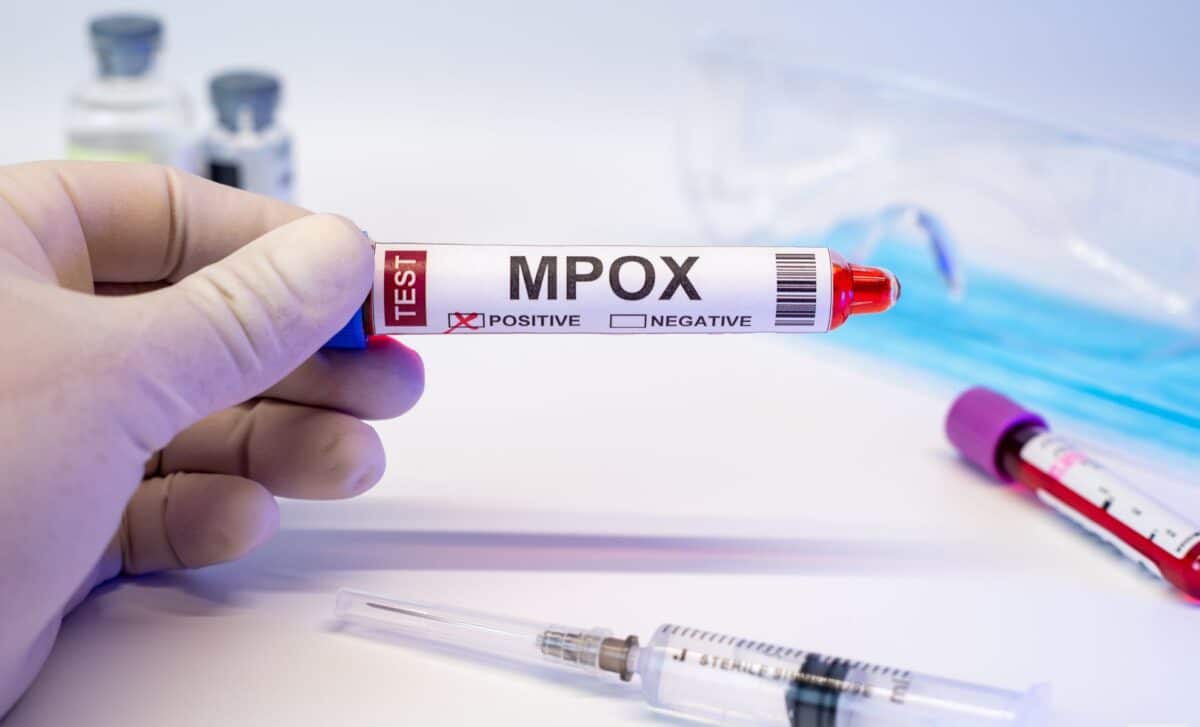 Un nouveau variant du mpox circule en Suisse romande, les autorités restent en alerte